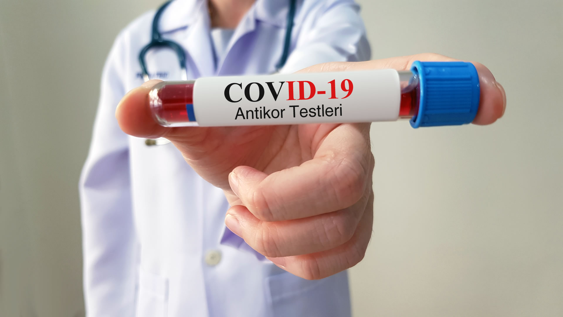 COVID-19 Numerical (Quantitative) IgG Antibody Test | Biruni Laboratuvarı