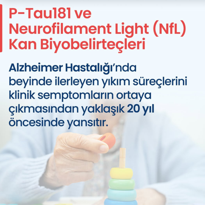Alzheimer Hastalığı v2