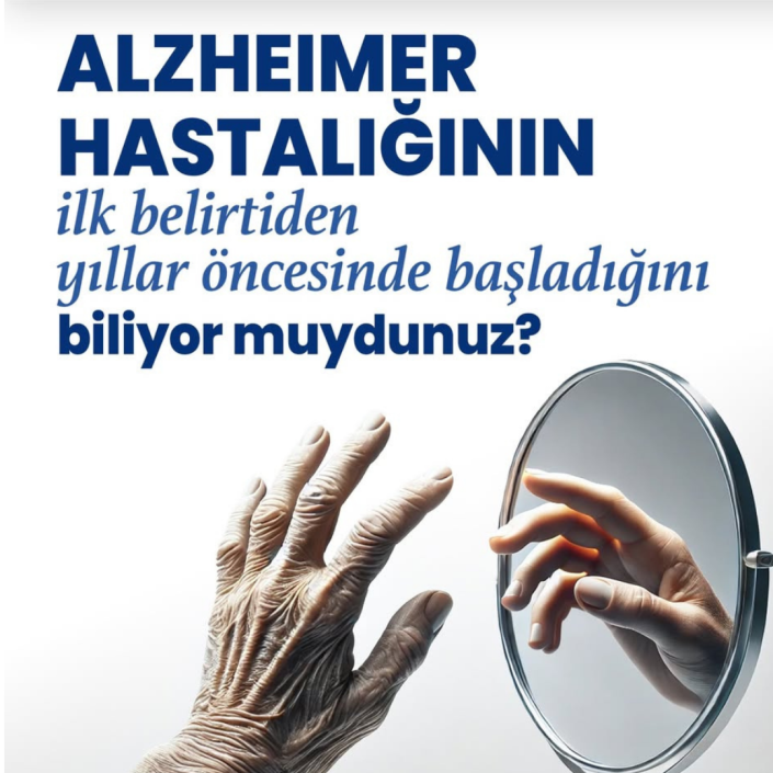 alzheimer ilk belirtileri