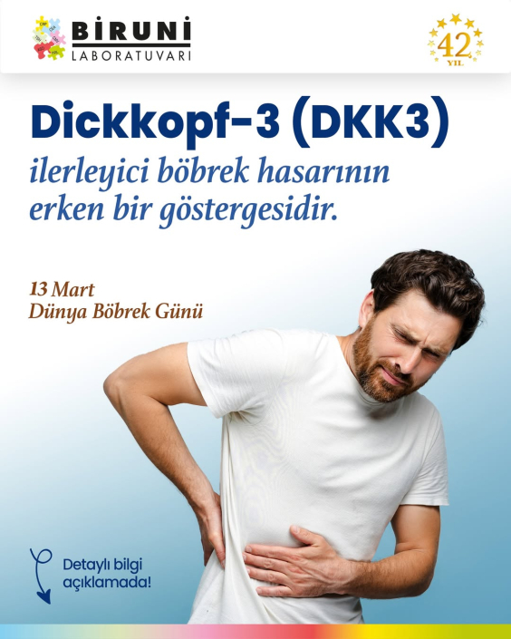 DKK3