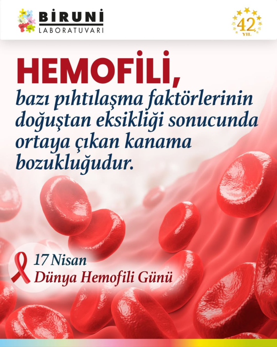hemofili tanı testleri