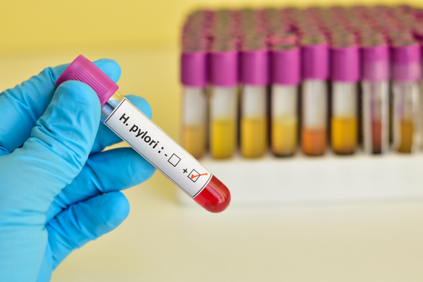 Helicobacter pylori testi sonucu veya analiz sürecini gösteren görsel