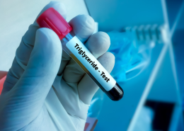 Trigliserit testi için laboratuvarda incelenmek üzere hazırlanan kan örneği tüpü
